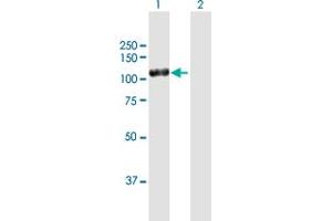 Western Blot analysis of DPP4 expression in transfected 293T cell line by DPP4 MaxPab polyclonal antibody. (DPP4 抗体  (AA 1-766))