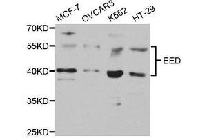 Western Blotting (WB) image for anti-Embryonic Ectoderm Development (EED) antibody (ABIN1876559) (EED 抗体)