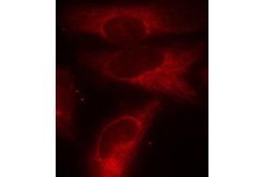 Immunofluorescence staining of methanol-fixed HeLa cells using Phospho-YWHAZ-S58 antibody (ABIN2987575). (14-3-3 zeta 抗体  (pSer58))