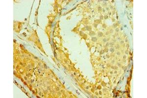 Immunohistochemistry of paraffin-embedded human testis tissue using ABIN7147263 at dilution of 1:100 (RAD1 抗体  (AA 1-282))