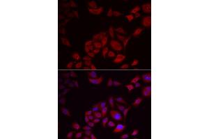Immunofluorescence analysis of U2OS cells using PIKFYVE antibody (ABIN5974035). (PIKFYVE 抗体)