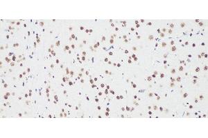 Immunohistochemistry of paraffin-embedded Rat brain using Bcl9 Polyclonal Antibody at dilution of 1:100 (20x lens). (BCL9 抗体)