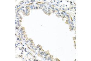 Immunohistochemistry of paraffin-embedded mouse lung using IL22 antibody at dilution of 1:100 (40x lens). (IL-22 抗体)