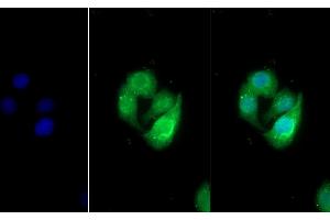 Detection of UMOD in Human Hela cell using Polyclonal Antibody to Uromodulin (UMOD) (Uromodulin 抗体  (AA 334-589))