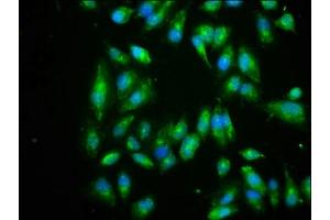 Immunofluorescence staining of Hela cells with ABIN7152162 at 1:266, counter-stained with DAPI.
