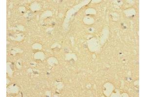Immunohistochemistry of paraffin-embedded human brain tissue using ABIN7163876 at dilution of 1:100 (WBSCR17 抗体  (AA 101-300))