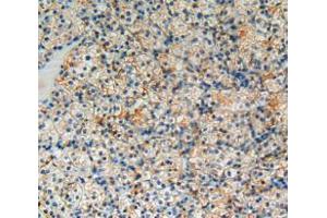 Used in DAB staining on fromalin fixed paraffin- embedded kidney cancer tissue (BCL2L1 抗体  (AA 2-212))