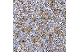 IHC analysis of RAB7/RAB7A using anti-RAB7/RAB7A antibody (ABIN7600597). (RAB7A 抗体  (AA 21-177))