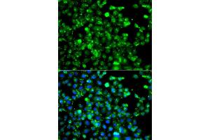 Immunofluorescence analysis of A549 cell using CAPN5 antibody. (Calpain 5 抗体)
