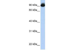 ELMO3 antibody used at 1 ug/ml to detect target protein. (ELMO3 抗体  (Middle Region))