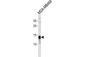 Western Blotting (WB) image for anti-Tumor Protein D52-Like 3 (TPD52L3) antibody (ABIN3004710)