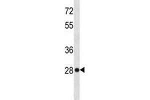Western Blotting (WB) image for anti-High Mobility Group Box 1 (HMGB1) (AA 152-180) antibody (ABIN3031204)