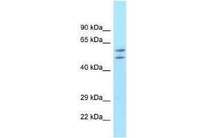 ATG16L1 antibody used at 1 ug/ml to detect target protein. (ATG16L1 抗体)