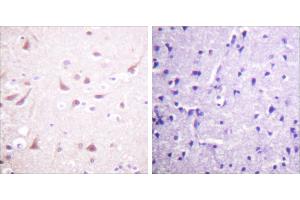 Peptide - + (DRP2 抗体  (Thr514))