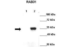 Lanes : Lane 1: GFP-Rab5 transfected cos cellsLane 2: GFP-Rab31 transfected cos cells  Primary Antibody Dilution :  1:500   Secondary Antibody : Goat anti rabbit-HRP  Secondary Antibody Dilution :  1:5000  Gene Name : RAB31  Submitted by : Ruth Herbst, Medical University Vienna (RAB31 抗体  (C-Term))