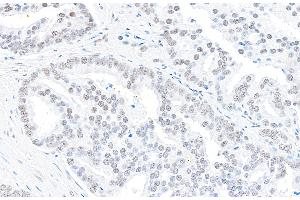 anti-ATP-Dependent RNA Helicase A (DHX9) (C-Term) antibody