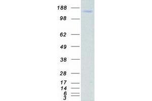 Western Blotting (WB) image for Slit Homolog 2 (Drosophila) (SLIT2) protein (Myc-DYKDDDDK Tag) (ABIN2732202)