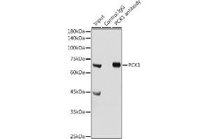 Immunoprecipitation analysis of 300 μg extracts of Mouse liver cells using 3 μg PCK1 antibody (ABIN3022753, ABIN3022754, ABIN3022755 and ABIN6219210). (PCK1 抗体  (C-Term))