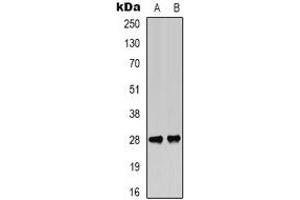 Western blot analysis of BCL2 (pT56) expression in Jurkat (A), rat muscle (B) whole cell lysates. (Bcl-2 抗体  (pSer56))