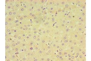 Immunohistochemistry of paraffin-embedded human liver tissue using ABIN7164598 at dilution of 1:100 (CPVL 抗体  (AA 23-476))
