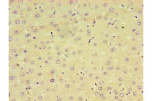 Immunohistochemistry of paraffin-embedded human liver tissue using ABIN7164598 at dilution of 1:100