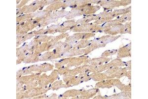 Immunohistochemistry of paraffin-embedded Rat heart using PSEN2 Polyclonal Antibody at dilution of 1:100 (40x lens). (Presenilin 2 抗体)