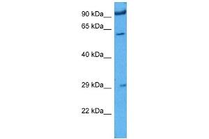 Host:  Rabbit  Target Name:  IGF2BP1  Sample Tissue:  Rat Skeletal Muscle  Antibody Dilution:  1ug/ml (IGF2BP1 抗体  (N-Term))