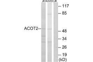 Western blot analysis of extracts from Jurkat cells and HuvEc cells, using ACOT2 antibody. (ACOT2 抗体  (Internal Region))