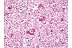 Immunohistochemistry (IHC) image for anti-Dapper, Antagonist of beta-Catenin, Homolog 1 (DACT1) (AA 725-775) antibody (ABIN1101069)