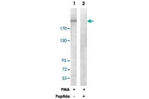 Western blot analysis of extracts from HepG2 cells, treated with PMA (125 ng/mL, 30 mins), using ITGB4 polyclonal antibody . (Integrin beta 4 抗体)
