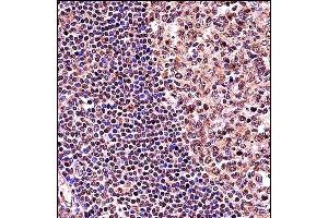 Immunohistochemistry (Paraffin-embedded Sections) (IHC (p)) image for anti-Transcription Factor 3 (E2A Immunoglobulin Enhancer Binding Factors E12/E47) (TCF3) (AA 506-534), (C-Term) antibody (ABIN657912)