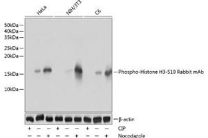 Western blot analysis of extracts of various cell lines, using Phospho-Histone H3-S10 Rabbit mAb (ABIN3019419, ABIN3019420, ABIN3019421, ABIN1681355 and ABIN7101861) at 1:1000 dilution.