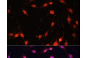 Immunofluorescence (IF) image for anti-Zinc Finger Protein 416 (ZNF416) antibody (ABIN7258204)