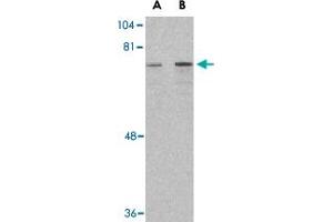 Western blot analysis of DDX3X in HepG2 cell lysate with DDX3X polyclonal antibody  at (A) 1 and (B) 2 ug/mL . (DDX3X 抗体  (Internal Region))