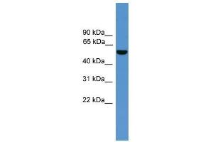 ALDH9A1 antibody used at 0. (ALDH9A1 抗体  (C-Term))