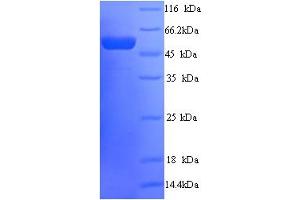 SDS-PAGE (SDS) image for Peter Pan Homolog (PPAN) (AA 1-473), (full length) protein (His tag) (ABIN5714474) (PPAN Protein (AA 1-473, full length) (His tag))