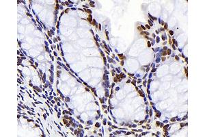 Immunohistochemistry analysis of paraffin-embedded mouse colon using S100A4 Monoclonal Antibody at dilution of 1:300. (s100a4 抗体)