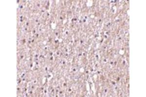 Immunohistochemistry of TWEAK in human brain tissue with this product at 10 μg/ml. (TWEAK 抗体)
