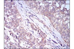 Immunohistochemistry (IHC) image for anti-Perilipin 2 (PLIN2) (AA 286-437) antibody (ABIN1724917)