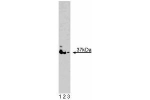 Western blot analysis of PINCH on K-562 lysate.