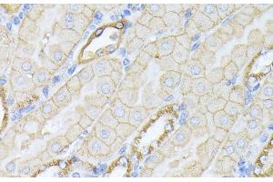 Immunohistochemistry (Paraffin-embedded Sections) (IHC (p)) image for anti-Spectrin alpha Chain, Brain (SPTAN1) antibody (ABIN7254764)