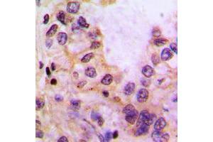 Immunohistochemistry (IHC) image for anti-Cytochrome P450, Family 39, Subfamily A, Polypeptide 1 (CYP39A1) (C-Term) antibody (ABIN7298138)