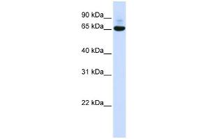 WB Suggested Anti-CNOT4 Antibody Titration:  0. (CNOT4 抗体  (N-Term))