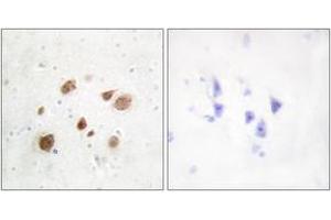 Immunohistochemistry (IHC) image for anti-Pregnancy Up-Regulated Non-Ubiquitously Expressed CaM Kinase (PNCK) (AA 161-210) antibody (ABIN2889644) (PNCK 抗体  (AA 161-210))