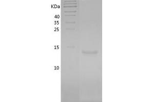 Western Blotting (WB) image for Leptin (LEP) (AA 22-167) protein (His tag) (ABIN7123746) (Leptin Protein (LEP) (AA 22-167) (His tag))
