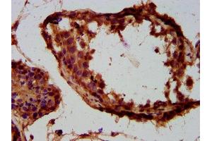 IHC image of ABIN7173930 diluted at 1:300 and staining in paraffin-embedded human testis tissue performed on a Leica BondTM system. (TUSC3 抗体  (AA 42-196))
