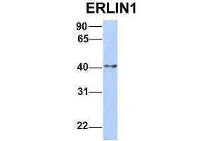 Host:  Rabbit  Target Name:  ERLIN1  Sample Type:  Human MCF7  Antibody Dilution:  1. (ERLIN1 抗体  (N-Term))