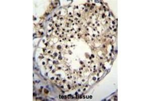 Immunohistochemistry (Paraffin-embedded Sections) (IHC (p)) image for anti-AlkB, Alkylation Repair Homolog 6 (ALKBH6) (AA 123-153), (Middle Region) antibody (ABIN950353)