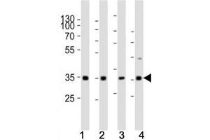 Western blot analysis of lysate from (1) human HeLa cell line, (2) mouse spleen, (3) rat lung, (4) rat stomach tissue using Cyclin D3 antibody at 1:1000. (Cyclin D3 抗体  (AA 33-66))