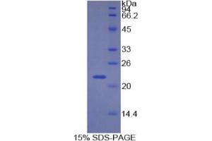 SDS-PAGE analysis of Human CDKN1A Protein. (p21 蛋白)